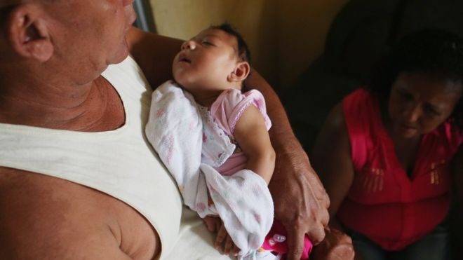 Impact of Zika virus is worst on unborn babies. Source: BBC